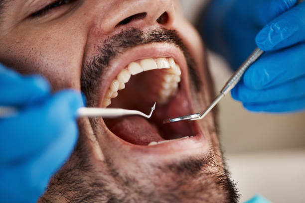 Best Weekend Emergency Dentist in Broadway, NC