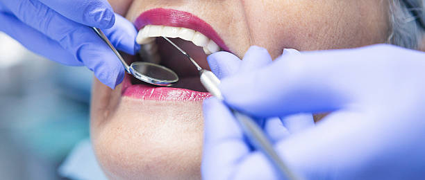 Best Emergency Dental Care for Broken or Chipped Teeth in Broadway, NC